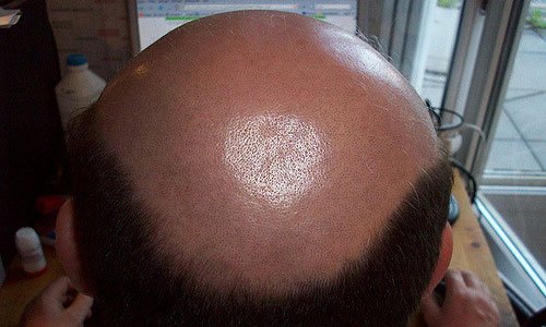 lisina.jpg lisina.jpg